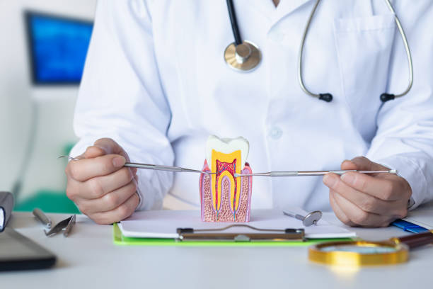 Best Knocked-Out Tooth (Avulsed Tooth) Treatment in West Park, NJ