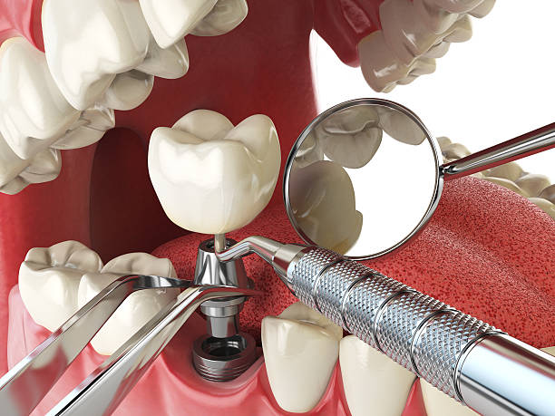 Best Broken or Chipped Tooth Repair in West Park, NJ
